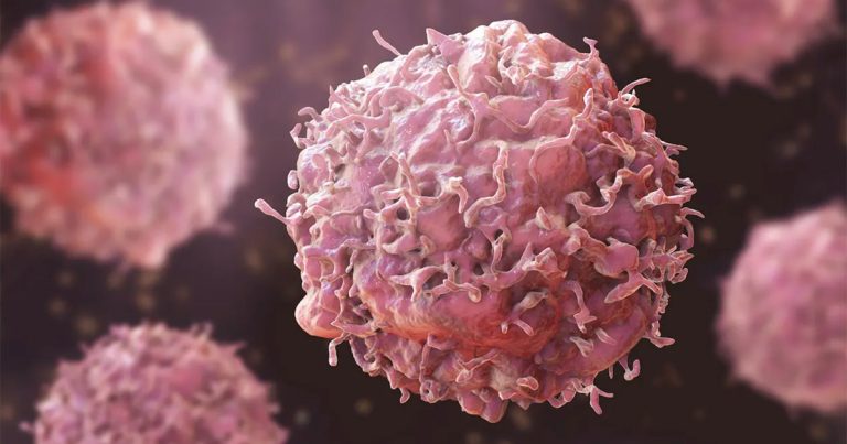 10 Ways to Reduce Your Cancer Risk
